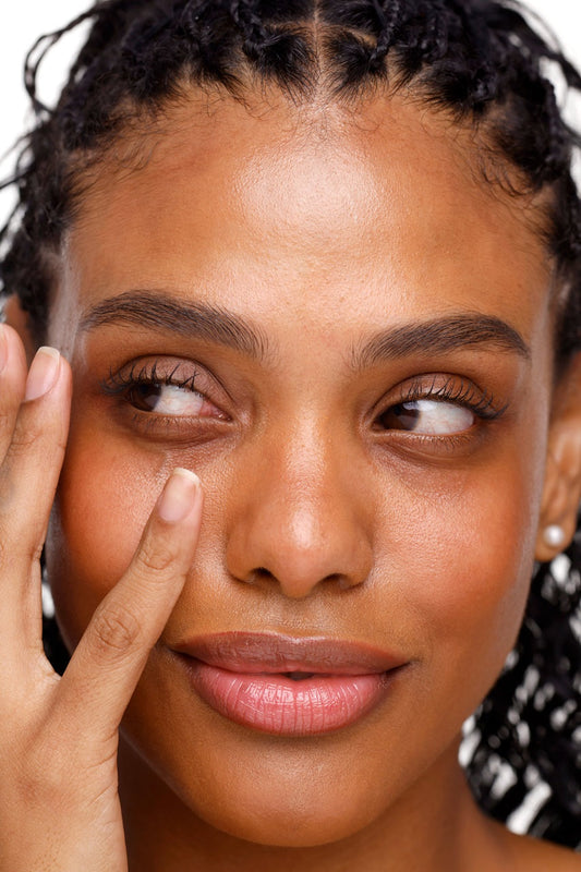 Olheiras: o que ajuda a reduzir o escurecimento