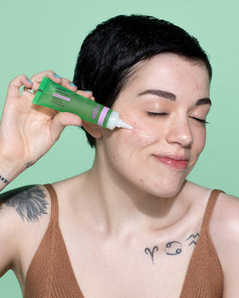 Os benefícios da niacinamida para a pele com acne