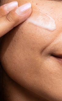 Como cuidar da pele no clima seco? Dermatologista explica