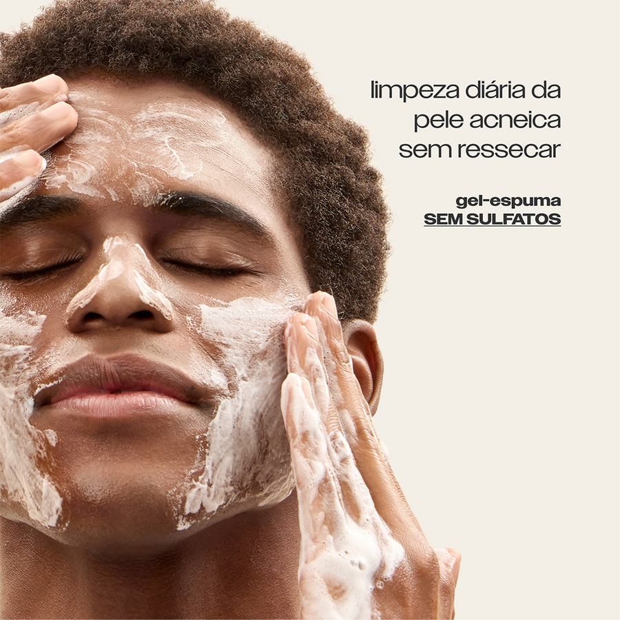 Limpador Antiacne Sallve aplicado no rosto – gel-espuma sem sulfatos para limpeza diária da pele acneica sem ressecar