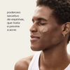 Sérum Antiacne Sallve aplicado no rosto – poderoso secativo de espinhas que trata e previne a acne