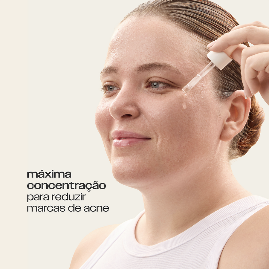 Super Ácido Salicílico 2% Sallve aplicado no rosto – máxima concentração para reduzir marcas de acne