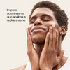 Tônico Antiacne Sallve aplicado no rosto – limpeza adstringente que acalma e reduz a acne
